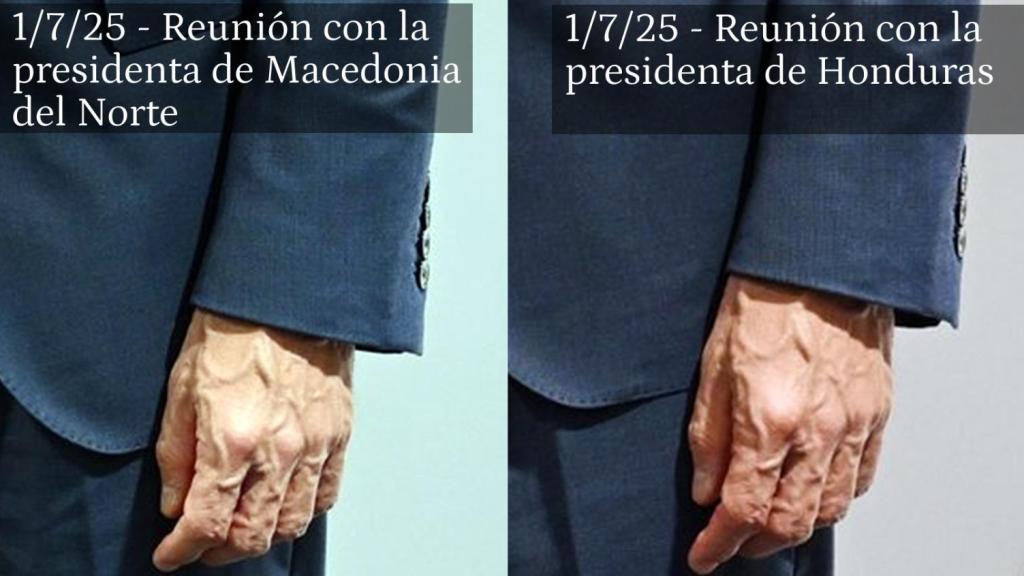 Imágenes de la mano izquierda de Pedro Sánchez obtenidas el 1 de julio, en Sevilla, durante sus reuniones con Gordana Silianovska-Davkova (Macedonia del Norte) y Xiomara Castro (Honduras).