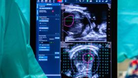  El cáncer de próstata no duele, no avisa y no perdona si llegas tarde