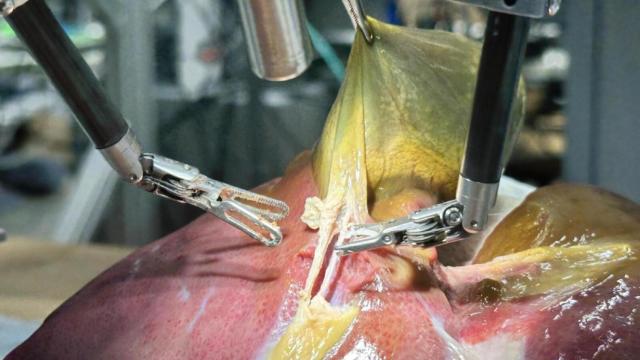 Un momento de la intervención realizada por el robot.