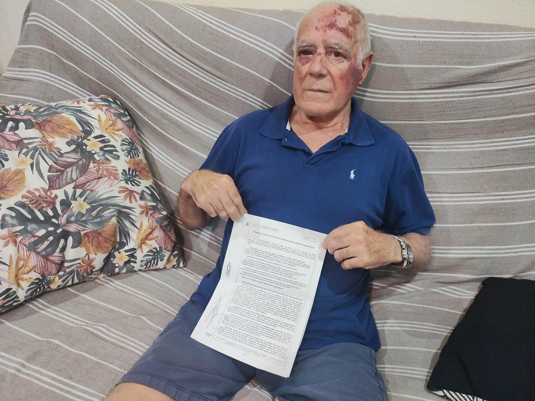 Domingo, este jueves, en el salón de su casa en Torre Pacheco, mostrando la denuncia que ha presentado por su agresión.
