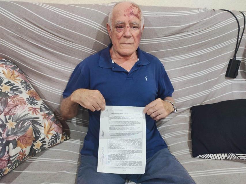 Domingo, en su casa de Torre Pacheco, mostrando la denuncia que ha presentado tras ser apaleado por un joven.