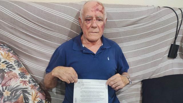 Domingo, en su casa de Torre Pacheco, mostrando la denuncia que ha presentado tras ser apaleado por un joven.