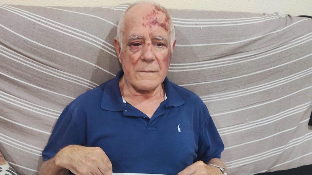 Domingo, en su casa de Torre Pacheco, mostrando la denuncia que ha presentado tras ser apaleado por un joven.