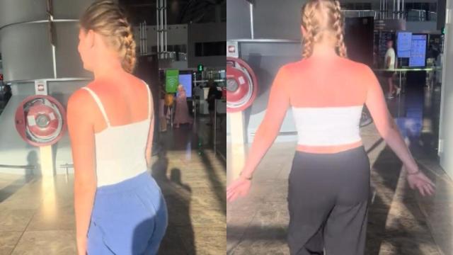 Las jóvenes enseñando su espalda tras su paso por Alicante.