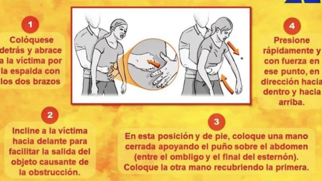Instrucciones de cómo utilizar la maniobra Heimlich