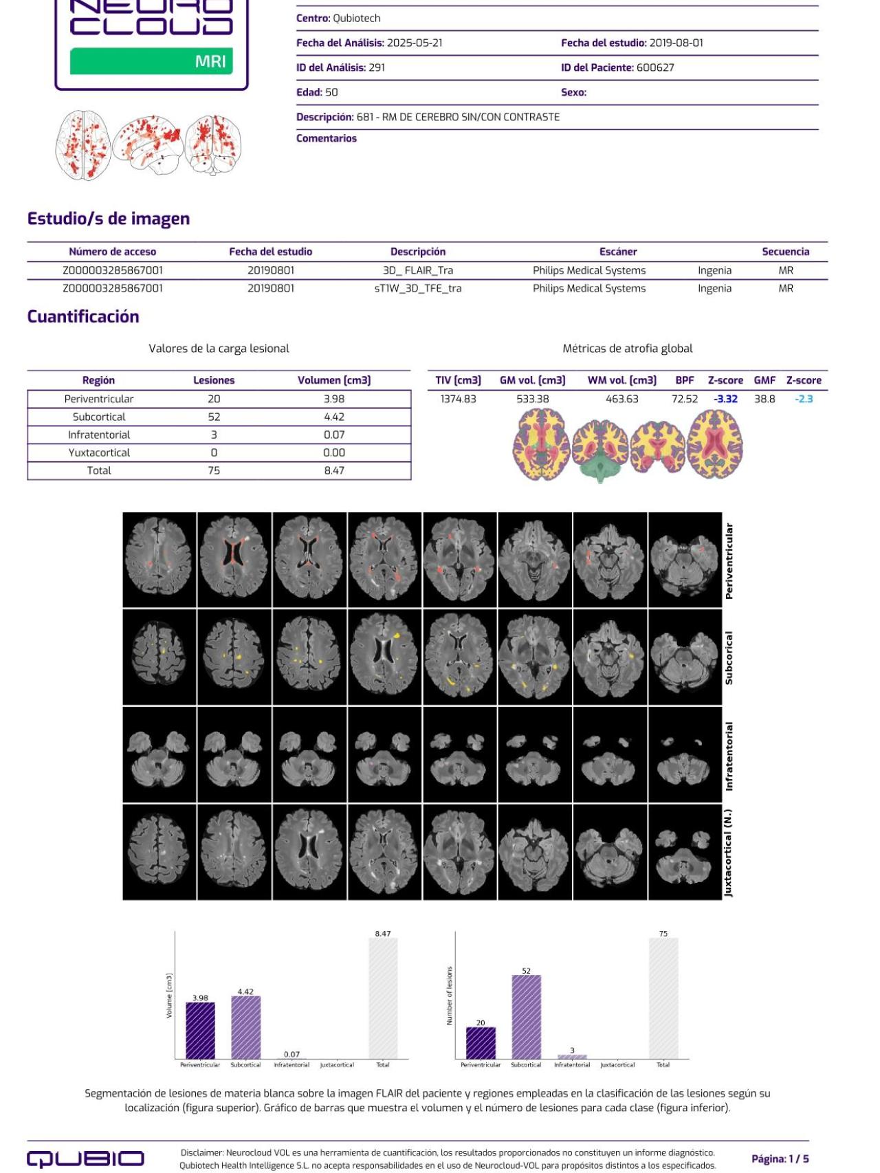 Ejemplo de un informe generado con Neurocloud.