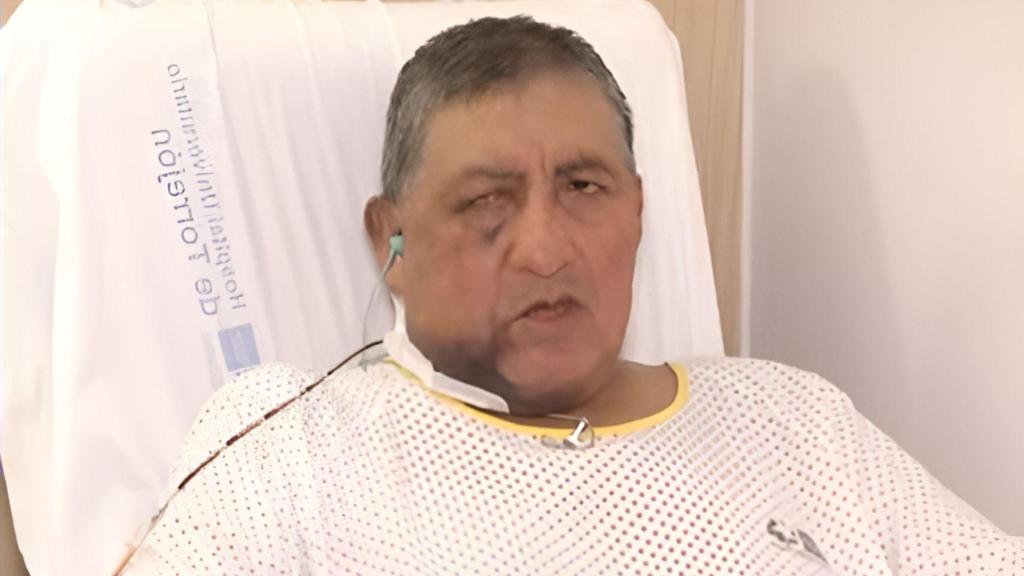 Esteban fue agredido en el portal de su casa.