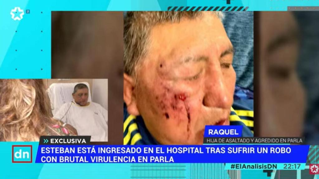 Esteban ha sufrido graves heridas.