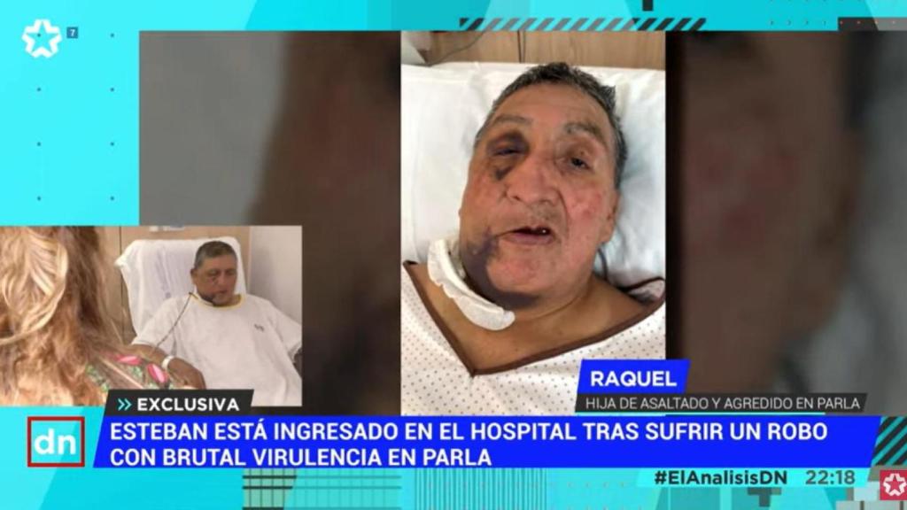 Así quedó Esteban tras la agresión.