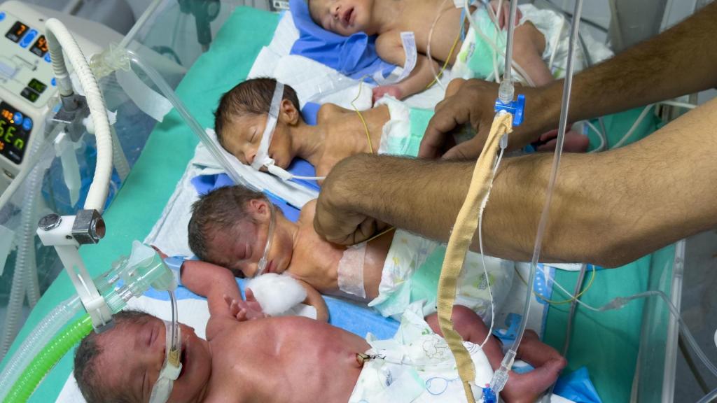 Fotografía del 17 de julio que muestra a cuatro niños nacidos prematuros y con signos de malnutrición, en una sola incubadora en el hospital Al Helou en Gaza.