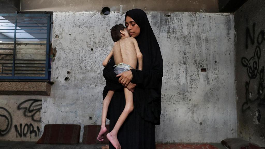 La madre desplazada Samah Matar sostiene a su hijo desnutrido Youssef en la ciudad de Gaza.