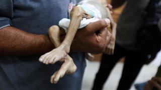 Israel permitirá la entrada de ayuda humanitaria en Gaza después de que 124 palestinos hayan muerto por desnutrición