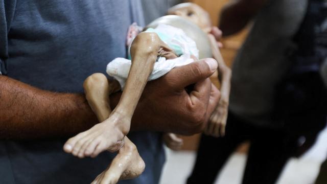 Un palestino sostiene el cuerpo de un bebé que murió por desnutrición.
