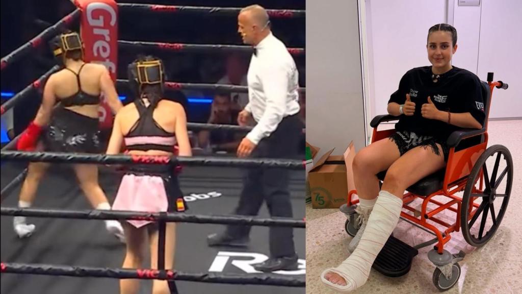 Roro se fractura el quinto metatarsiano del pie izquierdo.