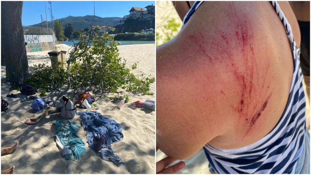 Acusan al Concello de Vigo de dejadez tras la caída de una rama que hirió a una bañista en Samil