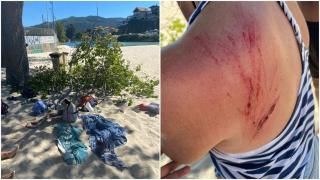 Acusan al Concello de Vigo de dejadez tras la caída de una rama que hirió a una bañista en Samil