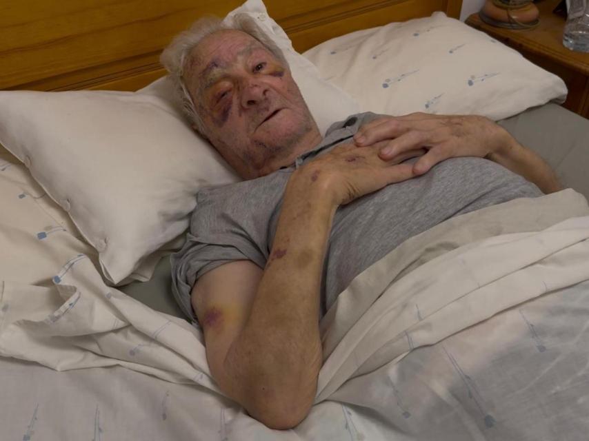 Vicente Romero, el anciano brutalmente agredido por su sobrina, postrado en su cama con las visibles lesiones.