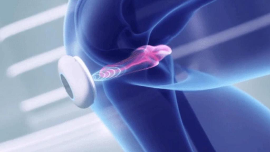 Funcionamiento de Softmoshi