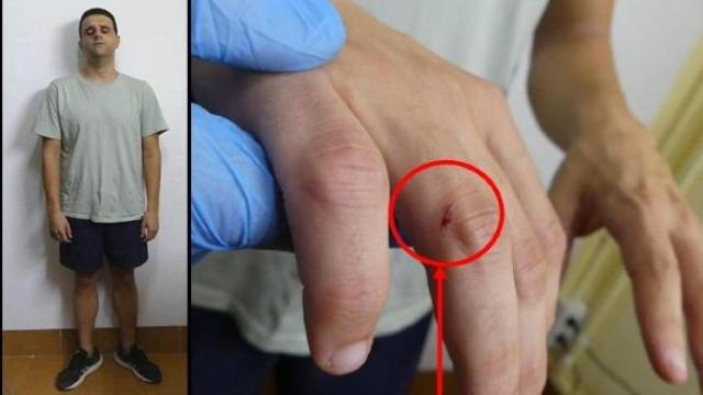 Felipe junior, tras ser detenido, junto a una imagen de su puño lesionado tras darle una paliza a su padre.