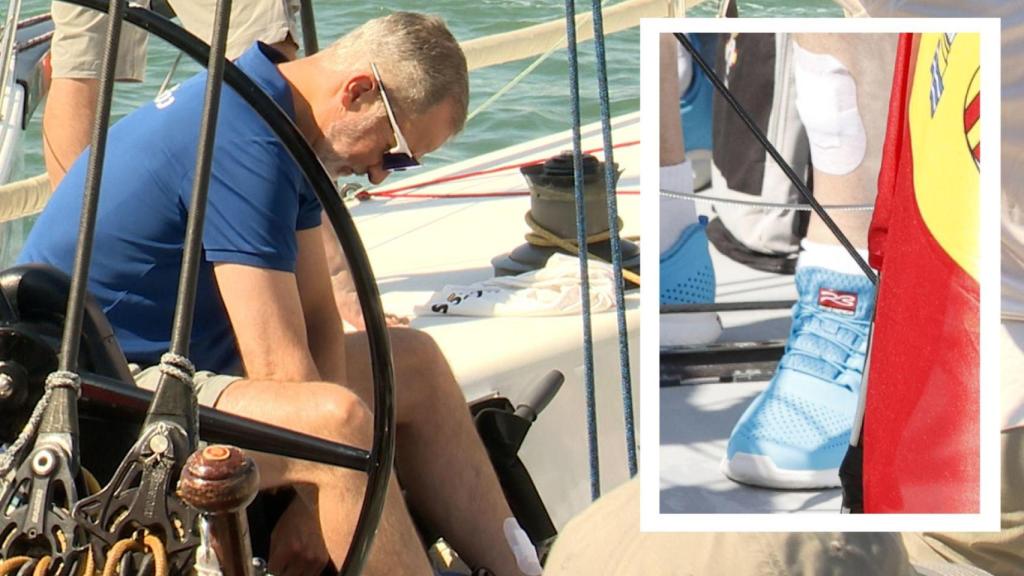 El rey Felipe VI, con un apósito en su pierna izquierda el pasado viernes, 1 de agosto, en Mallorca.