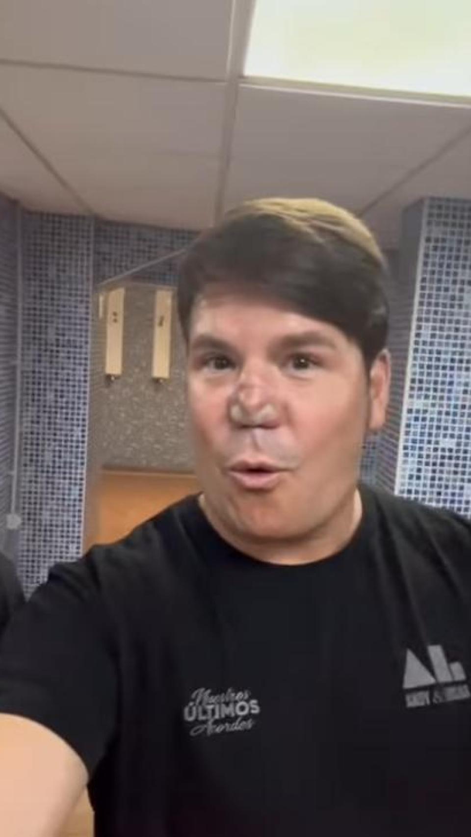 Lucas González, de Andy y Lucas, ha reaparecido con un pequeño apósito en la nariz.