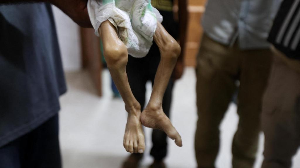 La bebé palestina Zainab Abu Haleeb el pasado 26 de julio tras morir por desnutrición.