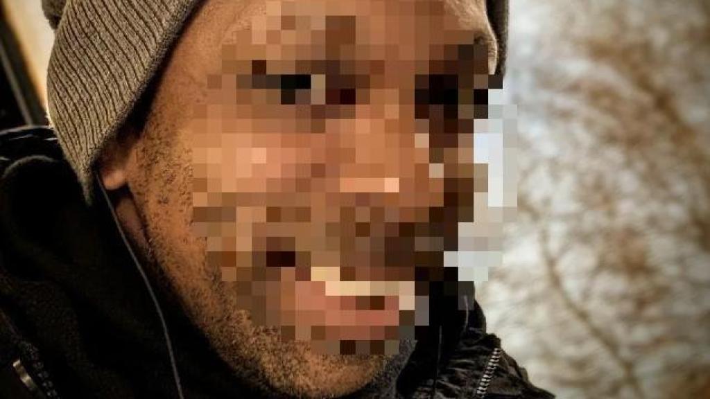 Martin, fallecido recientemente en Turquía por un tratamiento capilar.