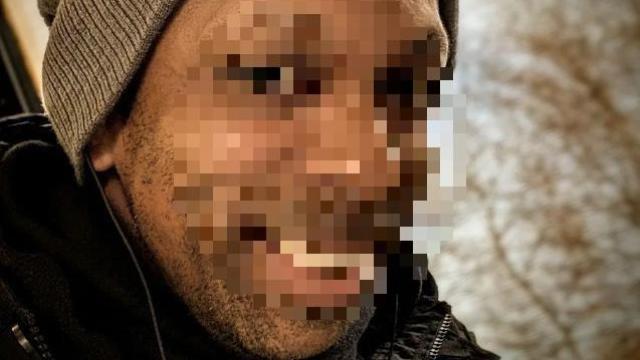 Martin, fallecido recientemente en Turquía por un tratamiento capilar.