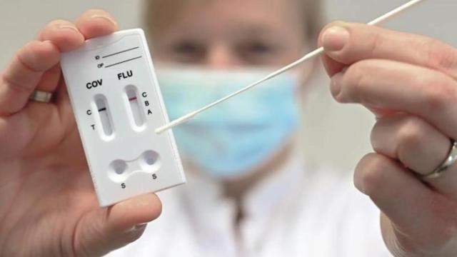 Los test de covid distinguen también entre gripe A, gripe B y virus sincitial.