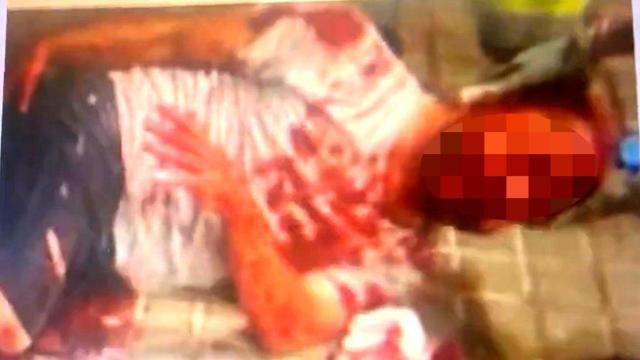 El agente bañado en sangre tras la brutal agresión.