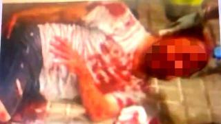 El agente bañado en sangre tras la brutal agresión.