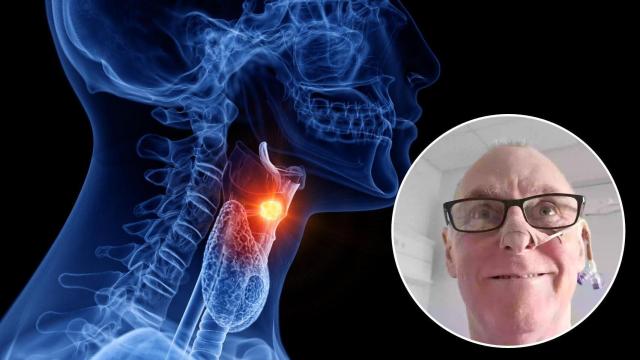 Frank contrajo el virus del papiloma humano por prácticas de riesgo,