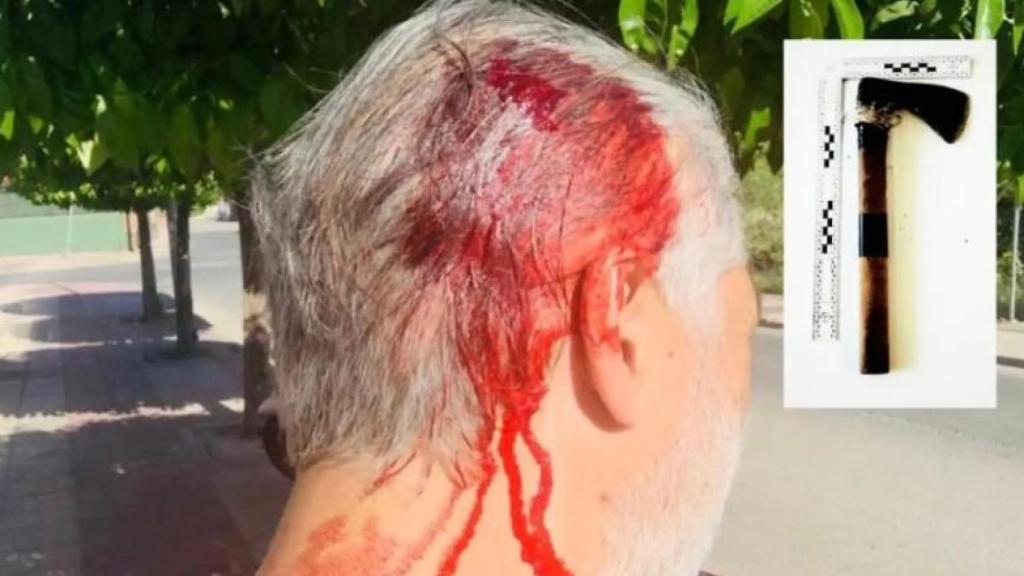 El subinspector de la Policía Nacional tras recibir un hachazo en la cabeza por Francisco por auxiliar a una mujer que había sufrido un robo.