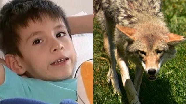 Un niño fue atacado por un coyote en California y tuvo que recibir 20 puntos.