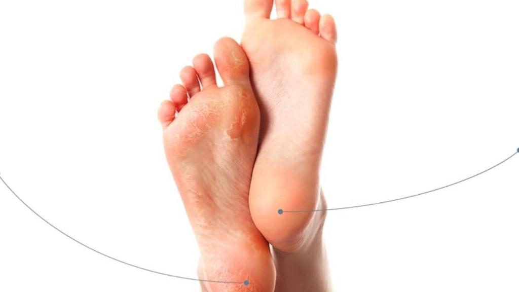 lima eléctrica de Essy