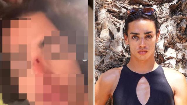 La víctima de agresión homófoba Daniel Campos.