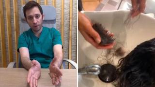 Oscar Muñoz- dermatólogo capilar