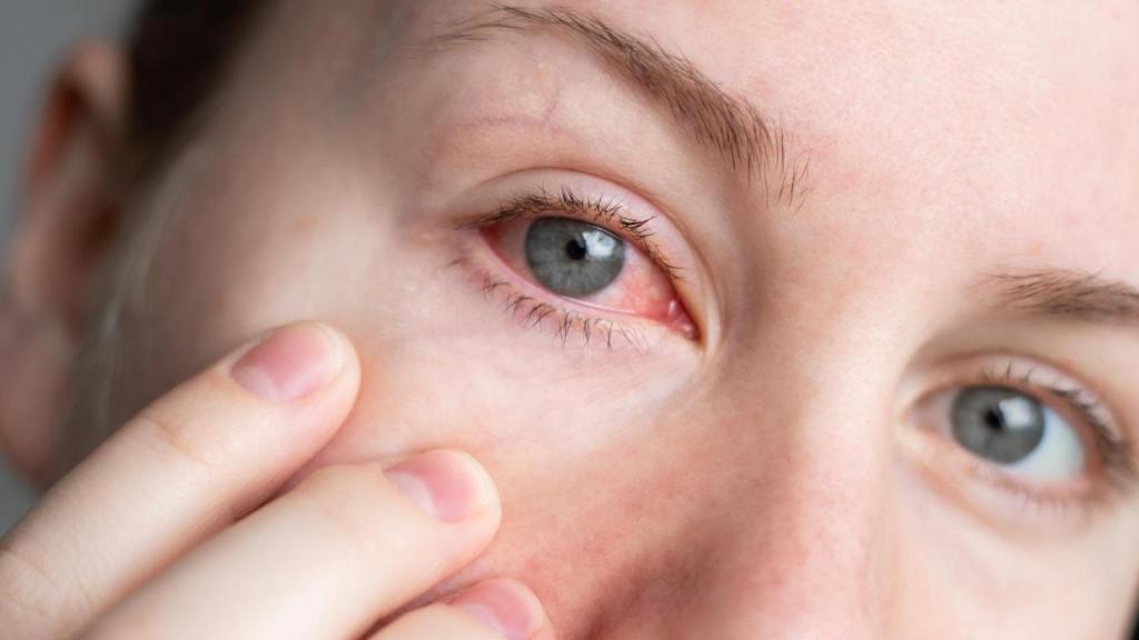 Mujer con una infección en el ojo