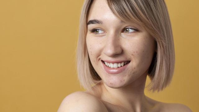 La crema correctora de L'Oréal con extracto de castaño de Indias promete disminuir manchas oscuras y marcas de acné con resultados visibles en una semana, según detalla Walmart EEUU.