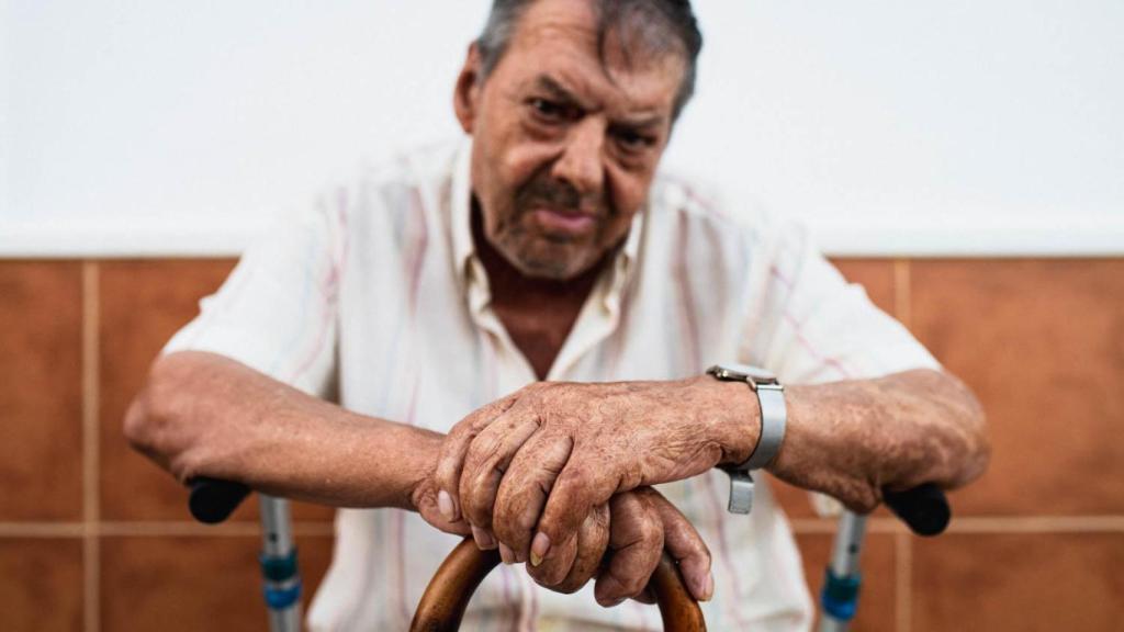 Juan pasó dos meses hospitalizado y se sometió a 20 injertos de piel.