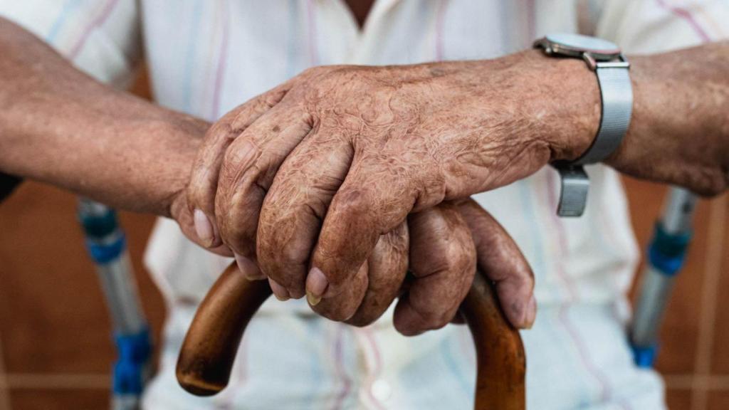 La piel quemada de Juan 33 años después de sobrevivir a una inversión térmica extinguiendo un incendio.