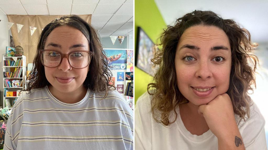 Iris Torrente, en la imagen de la izquierda, tras el trasplante de córnea; a la derecha, antes de haberse sometido a la operación.