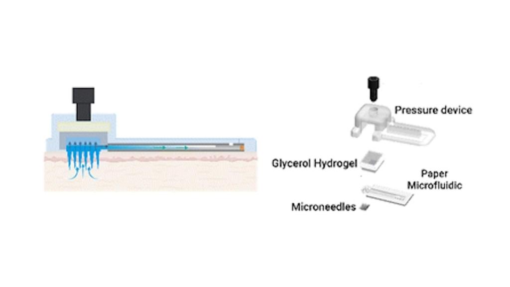 Diseño de parche con microagujas para detectar biomarcadores