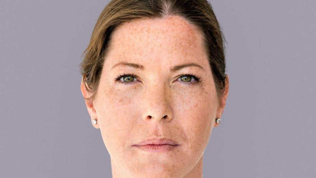 Adiós a las manchas del sol: esta es la crema despigmentante que cada año arrasa después del verano