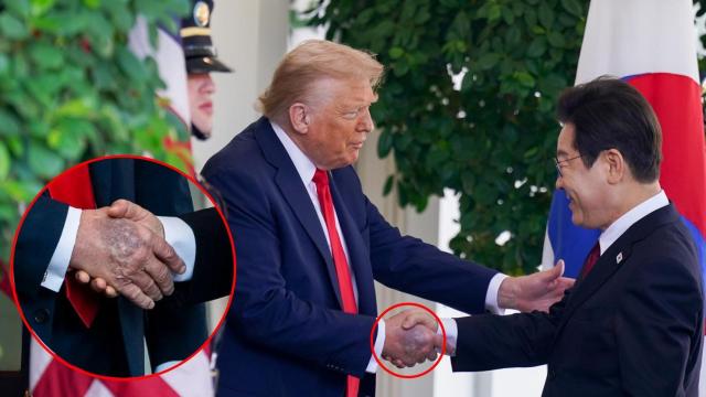 El moratón ha sido visible en el saludo al presidente surcoreano Lee Jae-myung.