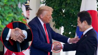 El moratón ha sido visible en el saludo al presidente surcoreano Lee Jae-myung.