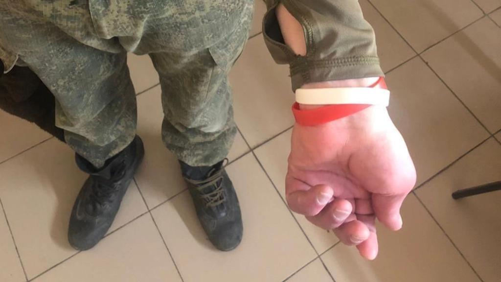 Los internos eran identificados con pulseras rojas o blancas según su enfermedad.