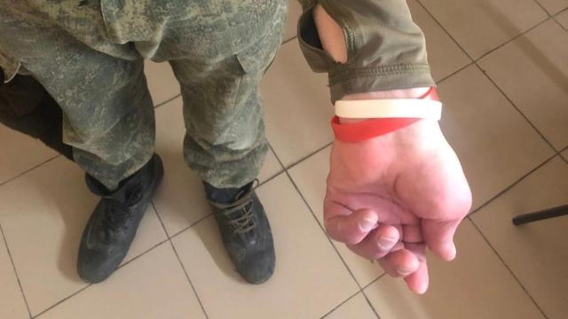 Los internos eran identificados con pulseras rojas o blancas según su enfermedad.