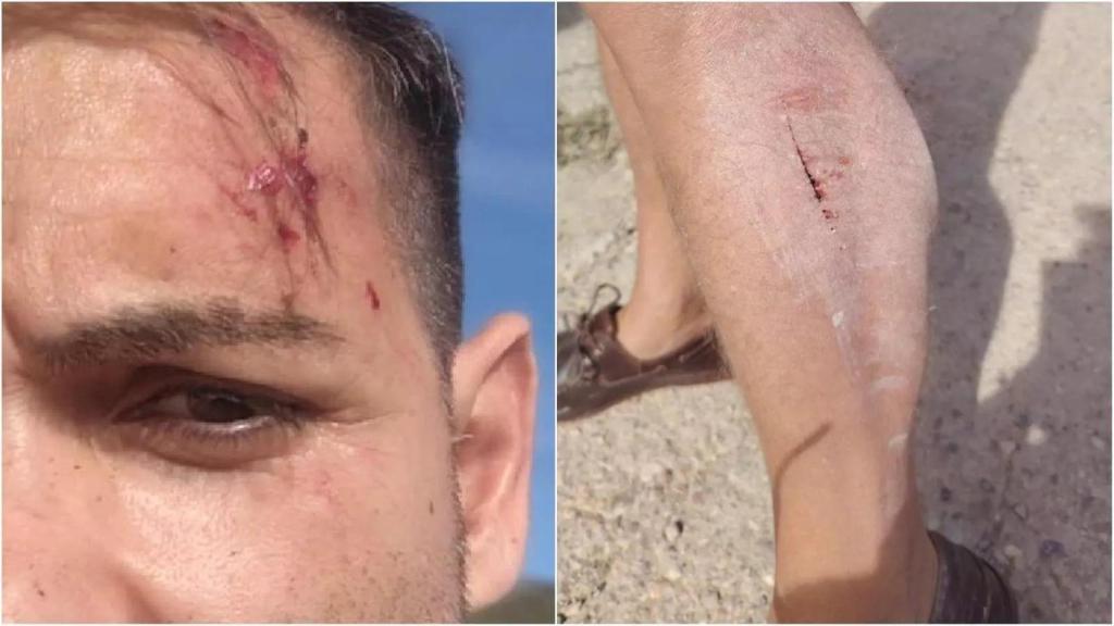 Un redactor y un cámara de À Punt, agredidos por dos pastores en Alcalà de Xivert. À Punt NTC