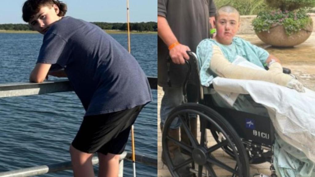 Un niño de Dallas sufre quemaduras tras hacer un reto de TikTok